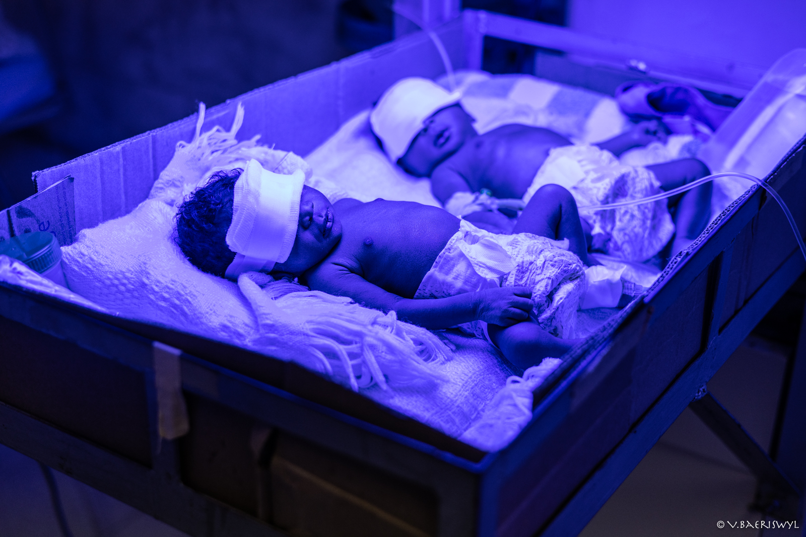 Pädiatrische Versorgung und die Internationale Gesundheitszusammenarbeit